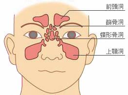 上顎 洞 炎 と は