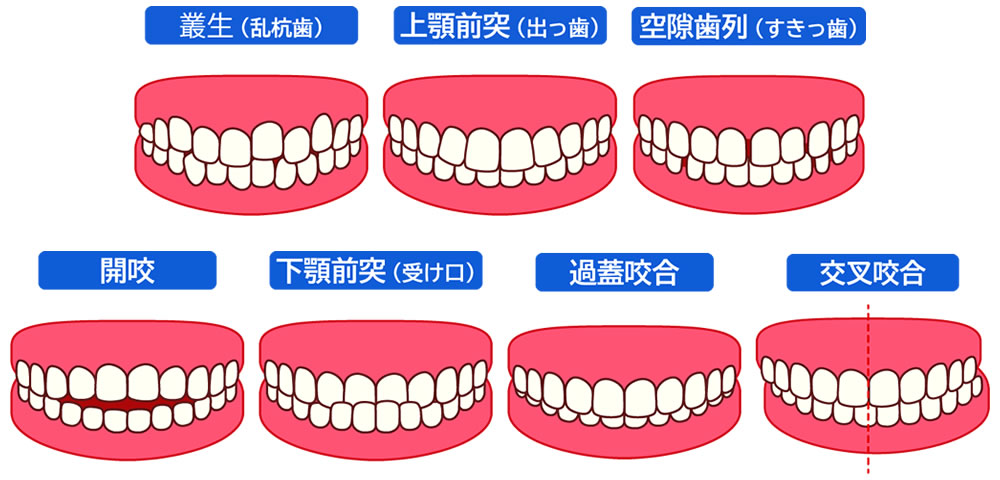 幅広い症例に適用できる