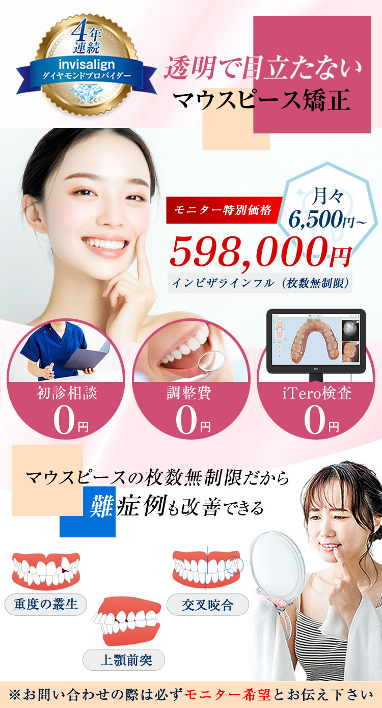 インビザラインキャンペーン